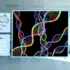 DNA Methylation Revolutionizes Neuroendocrine Cancer Diagnosis