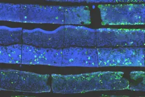 First Spatial Atlas of Failed IVF Endometrium Reveals Cellul - According to Nature, researchers have published the first spat